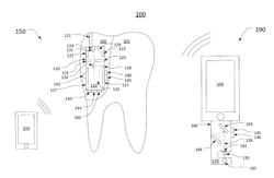 Determining food identities with intra-oral spectrometer devices