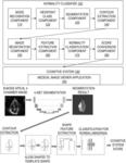 Automated normality scoring of echocardiograms