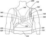 WEARABLE THERAPEUTIC DEVICE