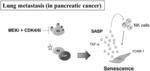 COMBINATION THERAPY WITH MEK INHIBITOR AND CDK4/6 INHIBITOR TO TREAT PANCREATIC CANCER