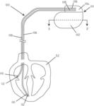 Medical device with convertible solid