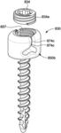 Anchors for vertebral body