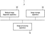 Image processing apparatus, medical image diagnostic apparatus, and program