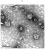 Composition for treating or preventing metabolic disease, containing, as active ingredient, extracellular vesicles derived from Akkermansia muciniphila bacteria