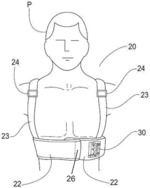 Features for Support Garment for a Wearable Medical Device