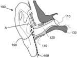MULTI-MIC EARPHONE DESIGN AND ASSEMBLY