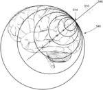 Multi-sphere head model for dipole localization