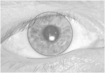 TORIC CONTACT LENS STABILIZATION DESIGN BASED ON THICKNESS GRADIENTS ORTHOGONAL TO EYELID MARGIN
