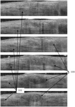 PROCESSING OPTICAL COHERENCE TOMOGRAPHY SCANS