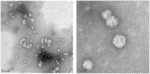 Equine Rotavirus Group B and Diagnosis