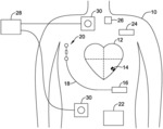 Communications in a medical device system with temporal optimization