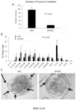 Dickkopf2 (Dkk2) inhibition suppresses tumor formation