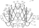 Multi-portion replacement heart valve prosthesis