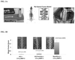 Nanofiber paste for growth factor delivery and bone regeneration