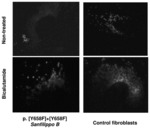 Bicalutamide analogs or (S)-bicalutamide as exocytosis activating compounds for use in the treatment of a lysosomal storage disorder or glycogenosis