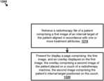 Radiotherapy methods, systems, and workflow-oriented graphical user interfaces