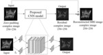 SYSTEMS AND METHODS FOR MAGNETIC RESONANCE IMAGE RECONSTRUCTION FROM INCOMPLETE K-SPACE DATA