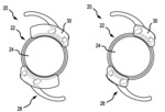 SYSTEMS TO AFFIX DEVICES TO INTRAOCULAR LENS ASSEMBLIES AND RELATED METHODS
