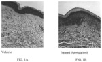 Lipidic furan, pyrrole, and thiophene compounds for use in the treatment of atrophic vaginitis