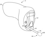 EAR-WEARABLE ELECTRONIC DEVICE INCLUDING MULTI-FUNCTION REMOVAL HANDLE