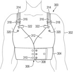 Wearable cardioverter defibrillator with breast support
