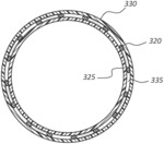 Rotational spun material covered medical appliances and methods of manufacture