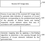 Retinal OCT data processing
