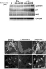 Suppression of Neuroinflammation and Composition and Method Therefore