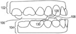 Dental appliance with repositioning jaw elements