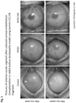 Treatment of cornea using laminin