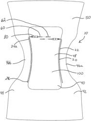 Underwear-integrated urine specimen collection system and method thereof