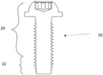 METHOD FOR PRODUCING A SCREW, AND SCREW