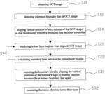 METHOD FOR MEASURING RETINAL LAYER IN OCT IMAGE